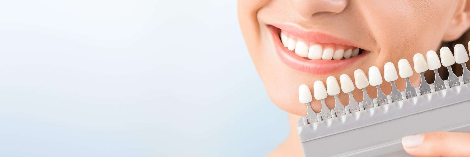 KöR Teeth Whitening | Dentist